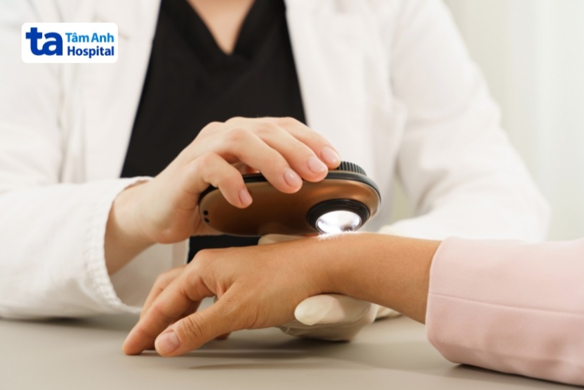 soi da để chẩn đoắc hắc tố navi