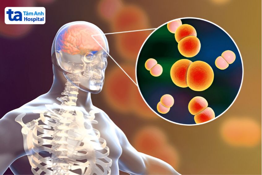 song cầu khuẩn Neisseria meningitidis gây bệnh ở người
