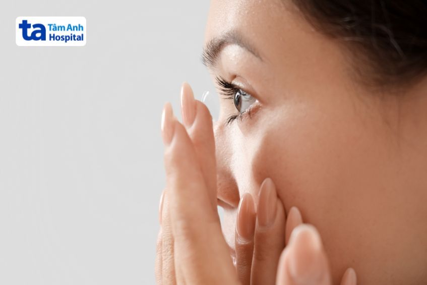 Sử dụng kính áp tròng