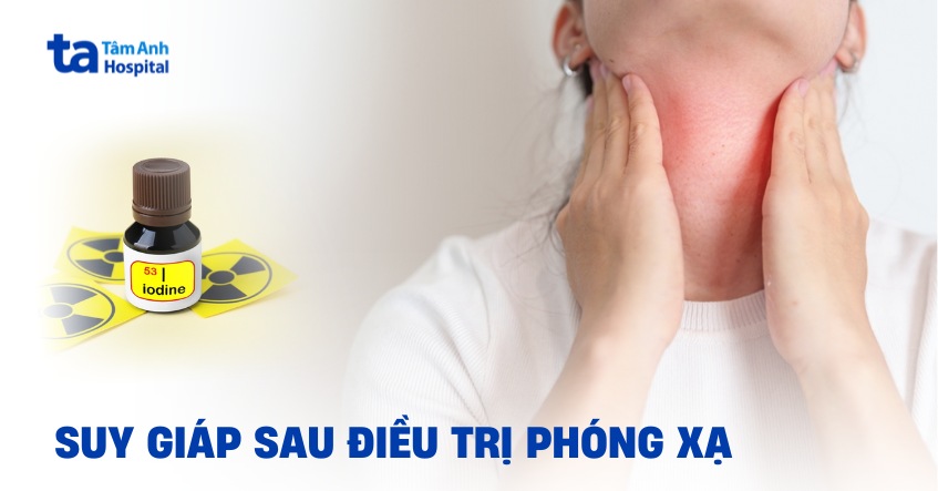 Tình trạng suy giáp sau điều trị phóng xạ nên xử lý thế nào?