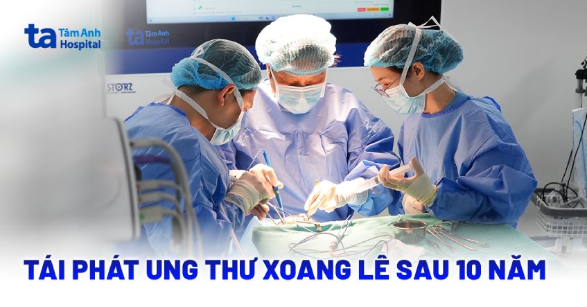 2 lần mắc ung thư xoang lê