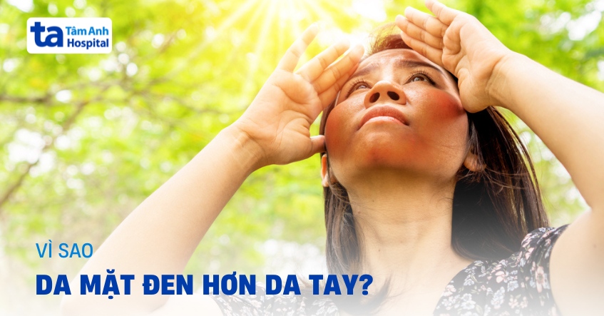 Giải đáp nhanh: Tại sao da mặt đen hơn da tay?
