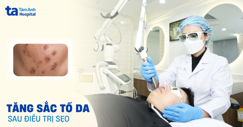 Tình trạng tăng sắc tố da sau điều trị sẹo làm sao để khắc phục?