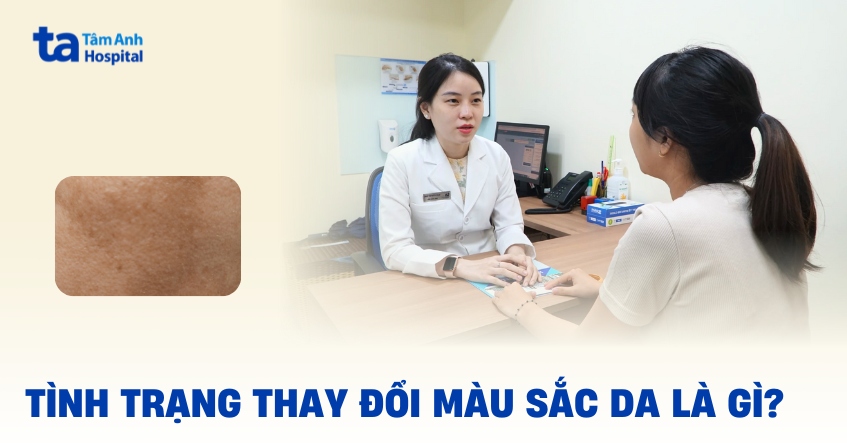 Hiện tượng thay đổi màu sắc da có đáng lo ngại về lâu dài?