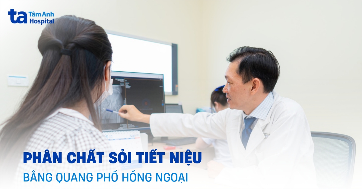 Thiết bị phân tích sỏi: Vai trò và nguyên lý hoạt động