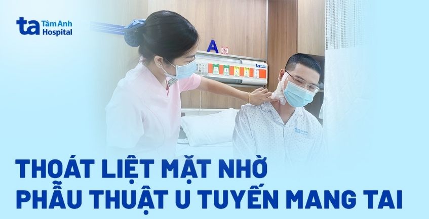 Thoát liệt mặt nhờ phẫu thuật u tuyến mang tai