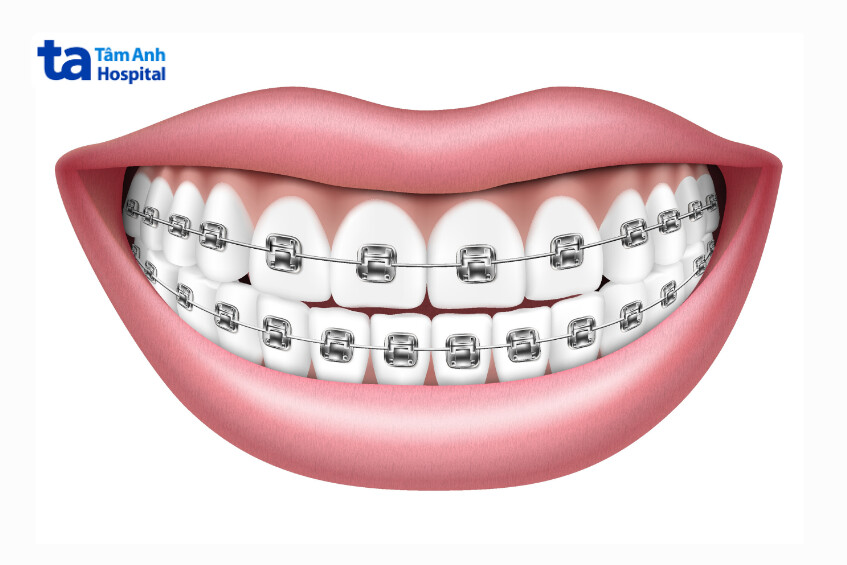 thời điểm nào thích hợp