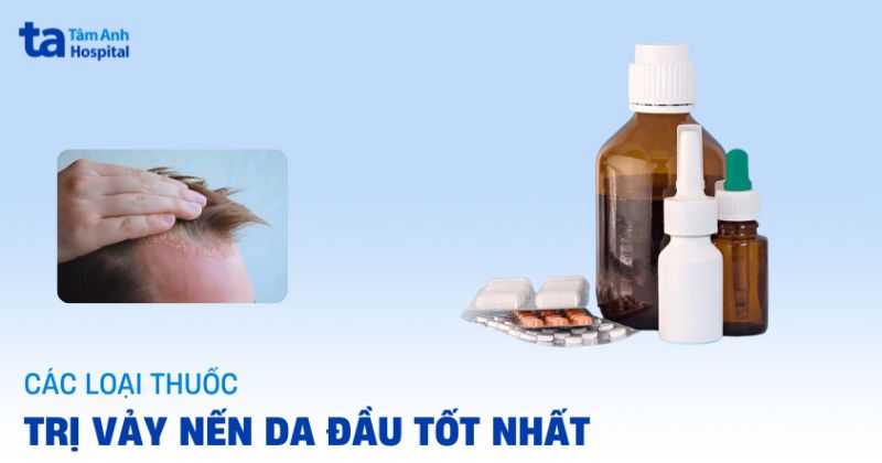 Thuốc trị vảy nến da đầu tốt hiện hay được bác sĩ tin dùng