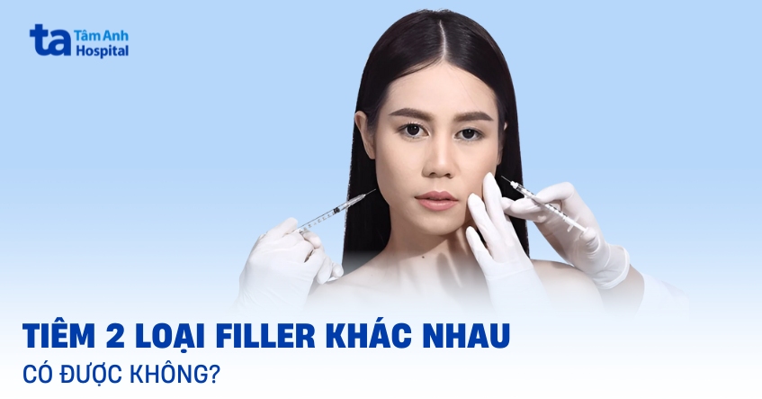Tiêm 2 loại filler khác nhau có sao không?