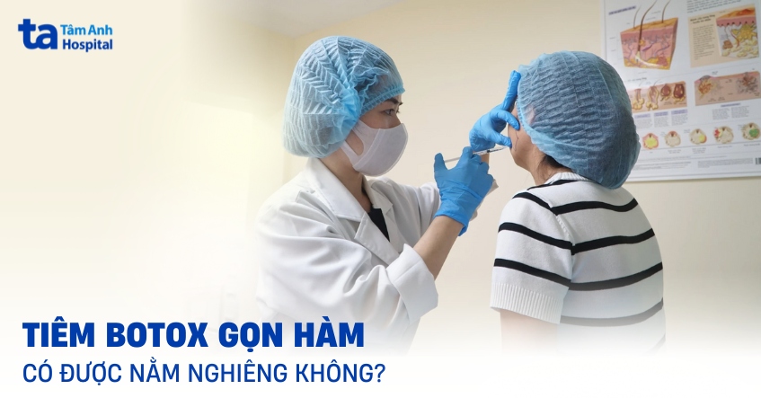tiêm botox gọn hàm có được nằm nghiêng không