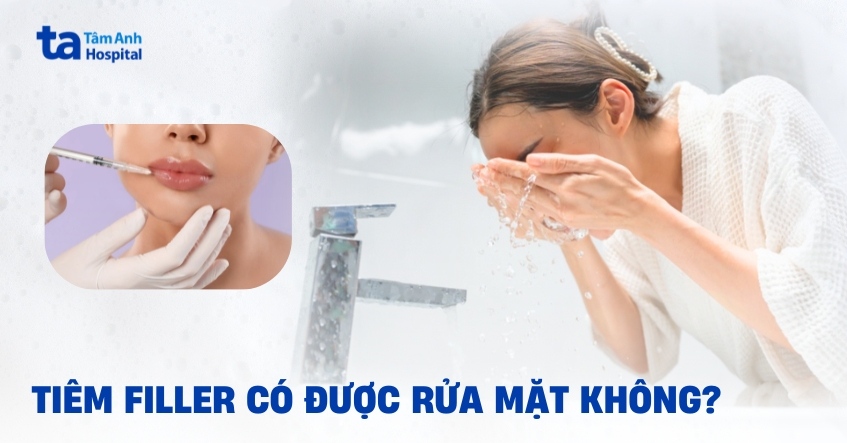 Giải đáp: Tiêm filler có được rửa mặt không?