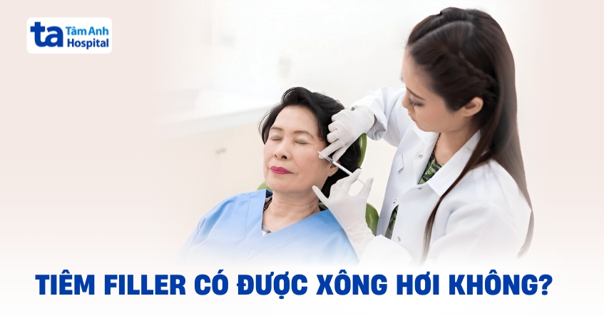 Tiêm filler có xông hơi được không? Khi nào có thể?