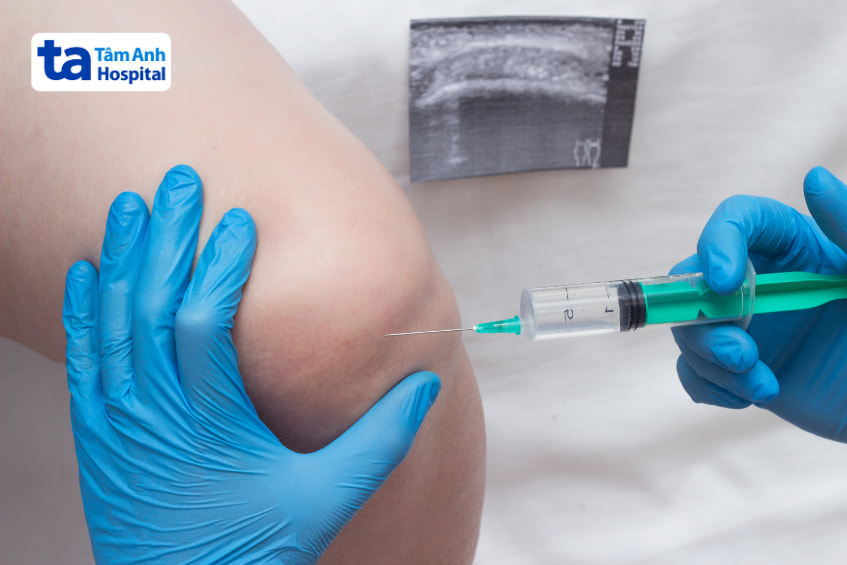 Tiêm natri hyaluronate vào khớp gối giúp hỗ trợ điều trị viêm khớp và giảm đau hiệu quả