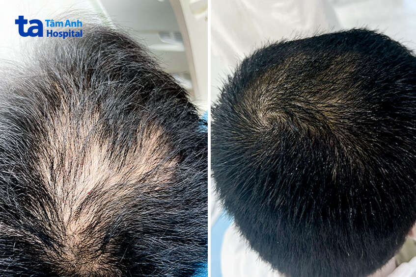 tình trạng đã được cải thiện đáng kể