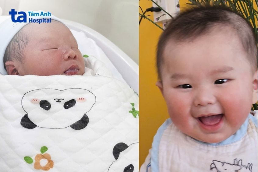 trẻ khỏe mạnh sau sinh