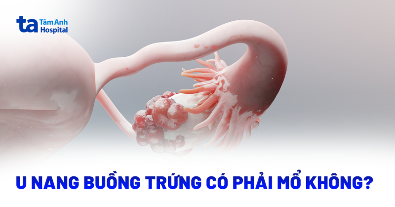 Bị u nang buồng trứng có phải mổ không​? Độ tuổi nào có thể?