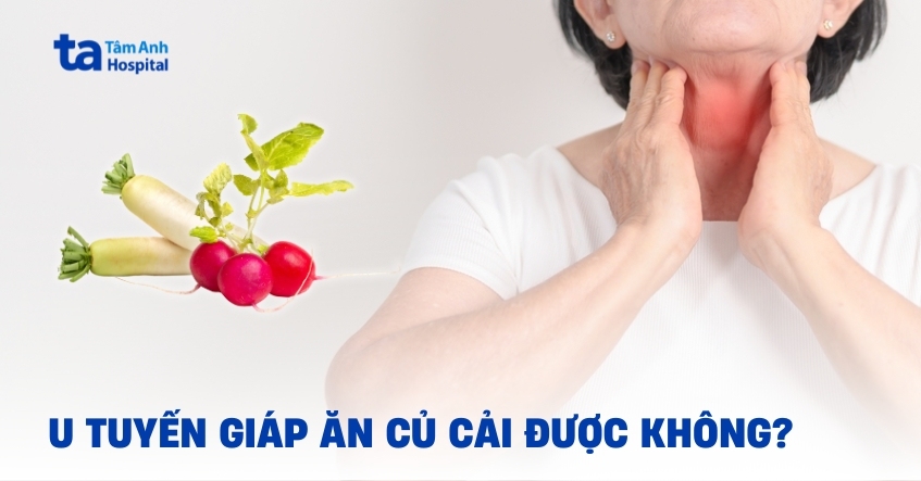 u tuyến giáp ăn củ cải được không