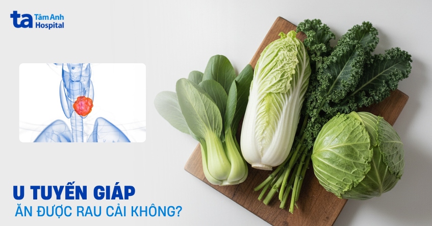 Bạn có biết: Người bị u tuyến giáp có ăn được rau cải không?