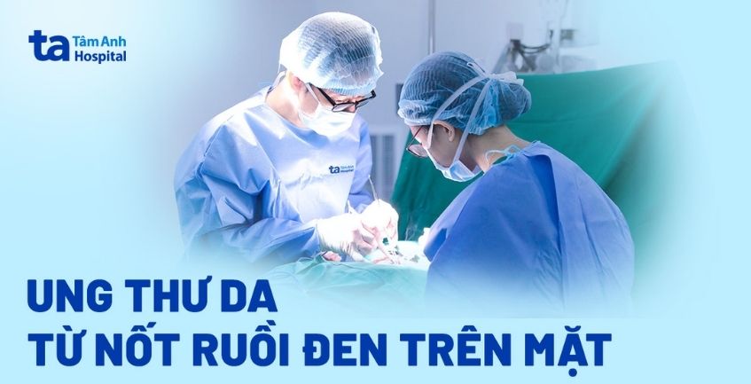Ung thư da từ nốt ruồi đen trên mặt