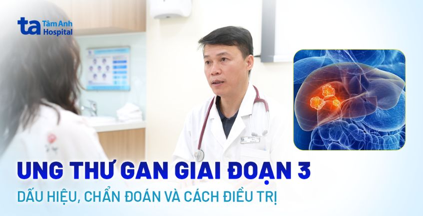 Tìm hiểu về ung thư gan giai đoạn 3