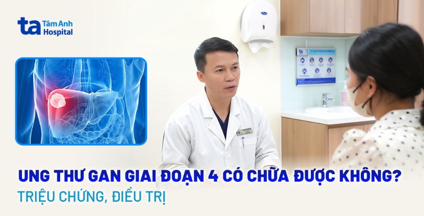 Ung thư gan giai đoạn 4 có chữa được không?
