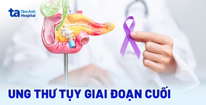 Ung thư tụy giai đoạn cuối: Tiên lượng và hướng chăm sóc