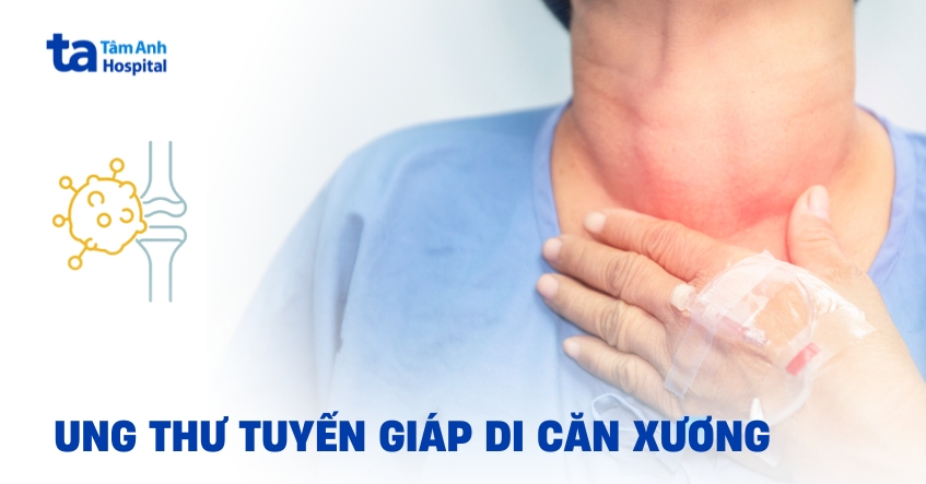 Tìm hiểu về tình trạng ung thư tuyến giáp di căn xương