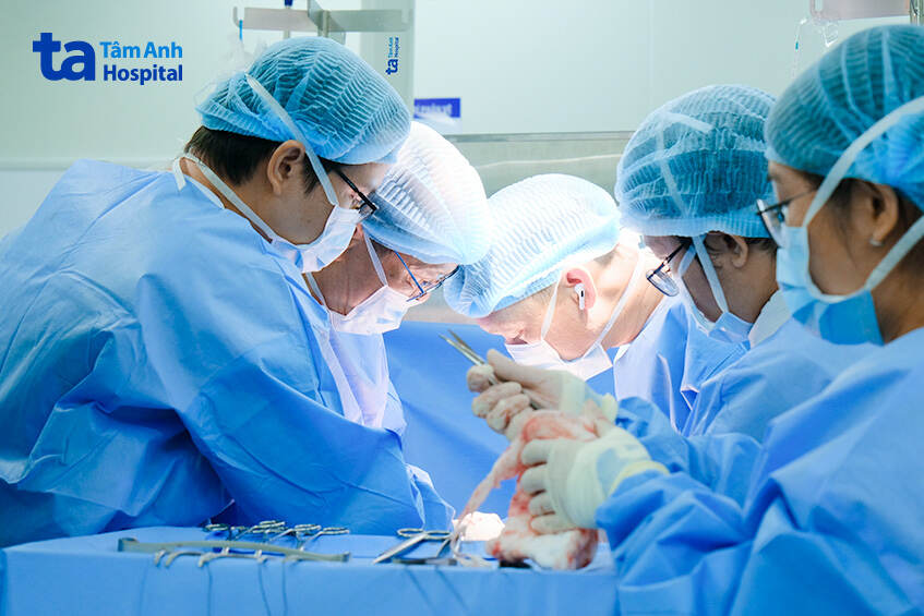 vẫn có nguy cơ tái phát sau phẫu thuật