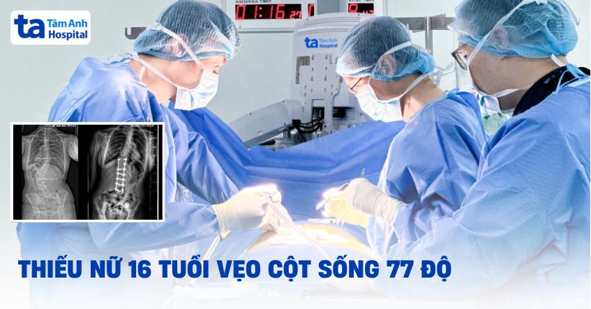 Thiếu nữ 16 tuổi vẹo cột sống 77 độ