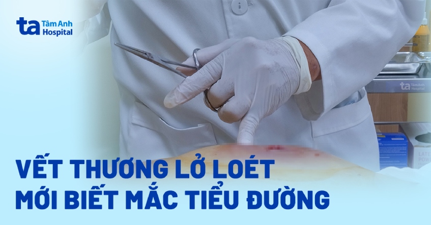 Vết thương lở loét mới biết mắc tiểu đường