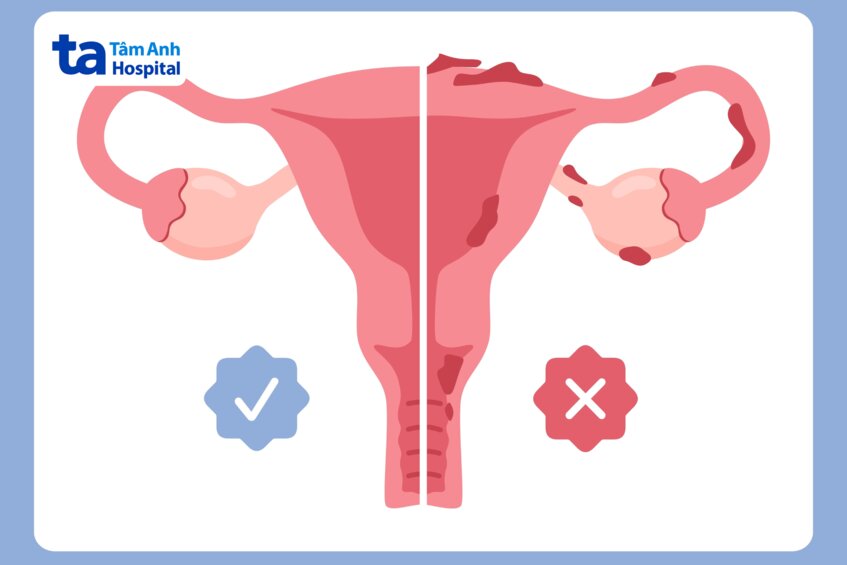 vị trí là yếu tố ảnh hưởng khả năng thành công