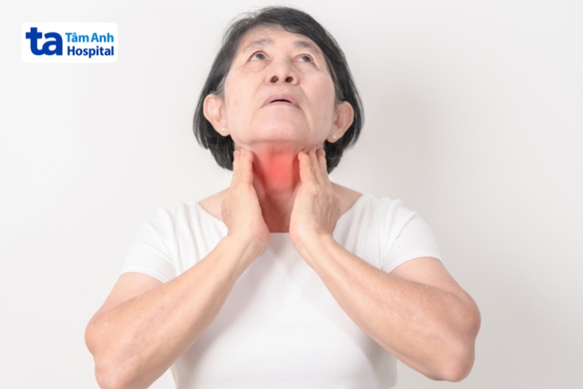 viêm tuyến giáp hashimoto là nguyên nhân hàng đầu gây suy giáp