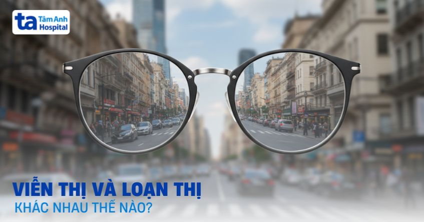 Viễn thị và loạn thị khác nhau thế nào?