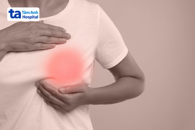 đau vú do biến đổi xơ nang