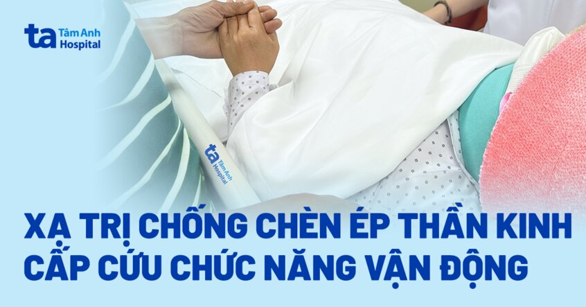 Xạ trị chống chèn ép thần kinh cấp cứu chức năng vận động