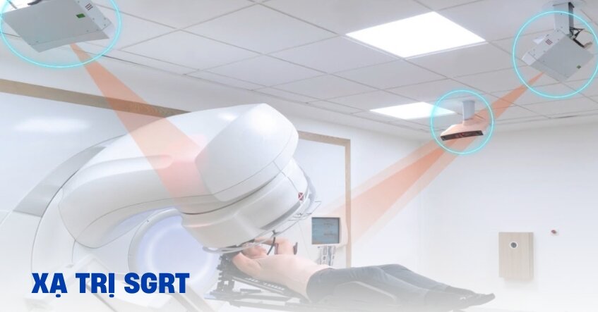 Phương pháp xạ trị có hướng dẫn bề mặt SGRT