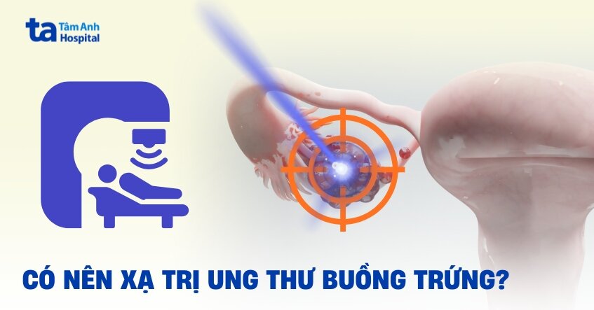 xạ trị ung thư buồng trứng