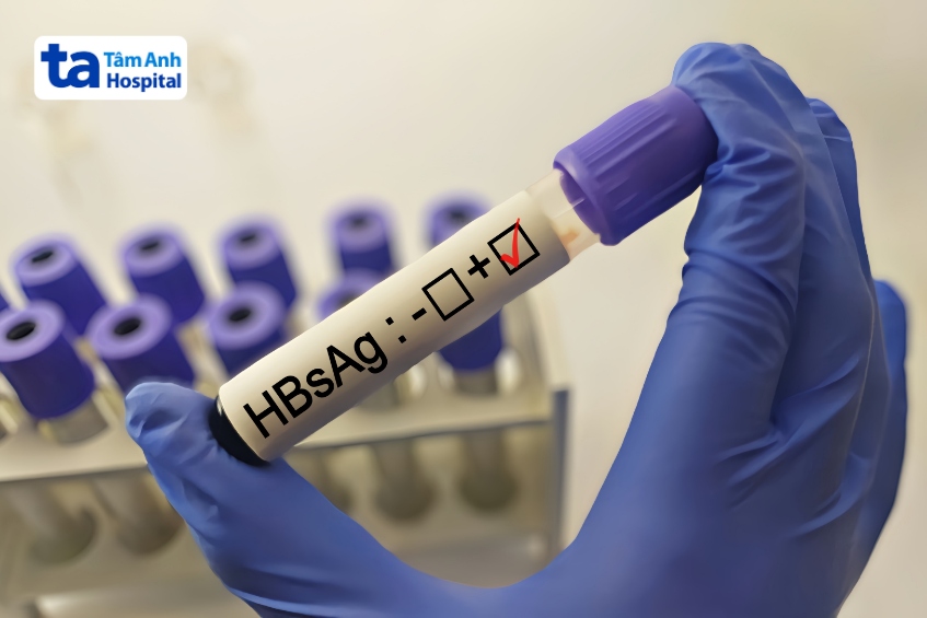 xét nghiệm hbsag