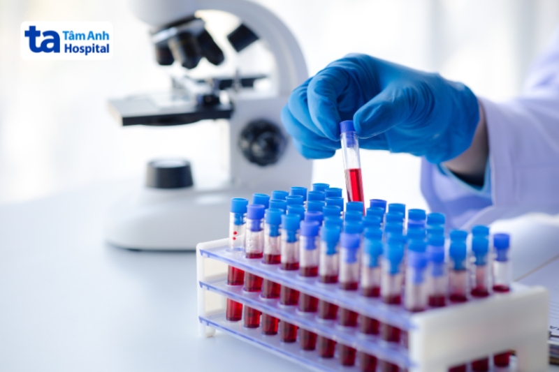 huyết thanh học phát hiện bạch hầu