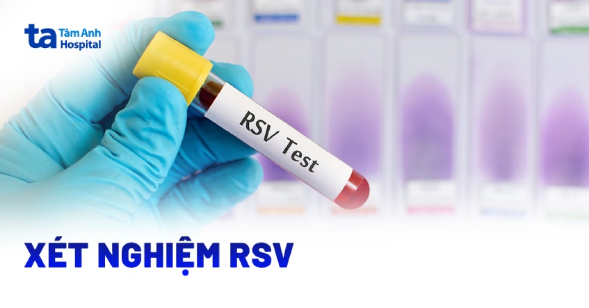 Có bao nhiêu loại xét nghiệm RSV? Những ai cần test?