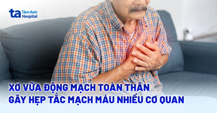 Xơ vữa động mạch toàn thân, cụ ông 71 tuổi hẹp tắc mạch máu nhiều cơ quan