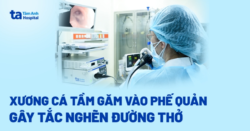 Xương cá tầm găm vào phế quản gây tắc nghẽn đường thở