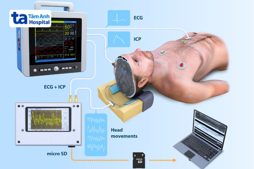 Mô phỏng quá trình đo áp lực nội sọ