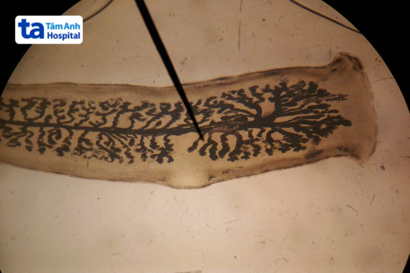 ảnh thân sán dây bò