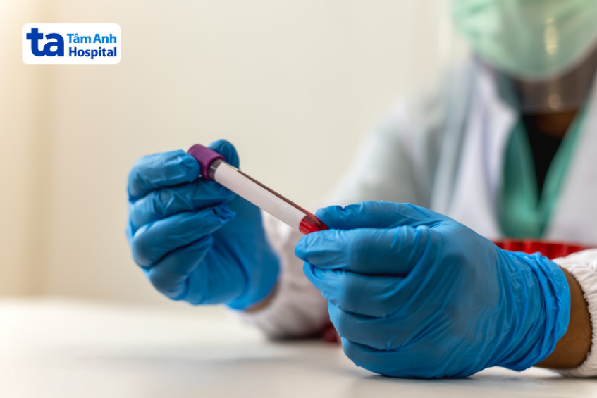 bác sĩ cầm ống nghiệm máu