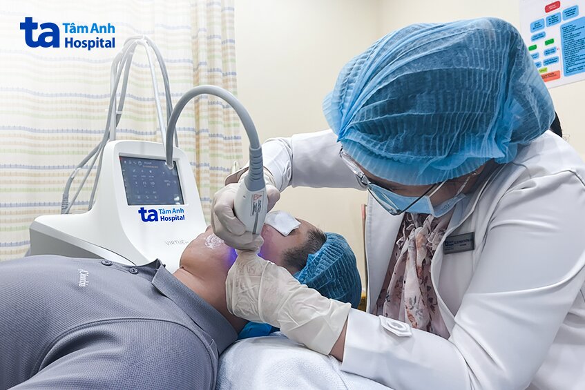 bác sĩ đang công nghệ rf trị sẹo rỗ