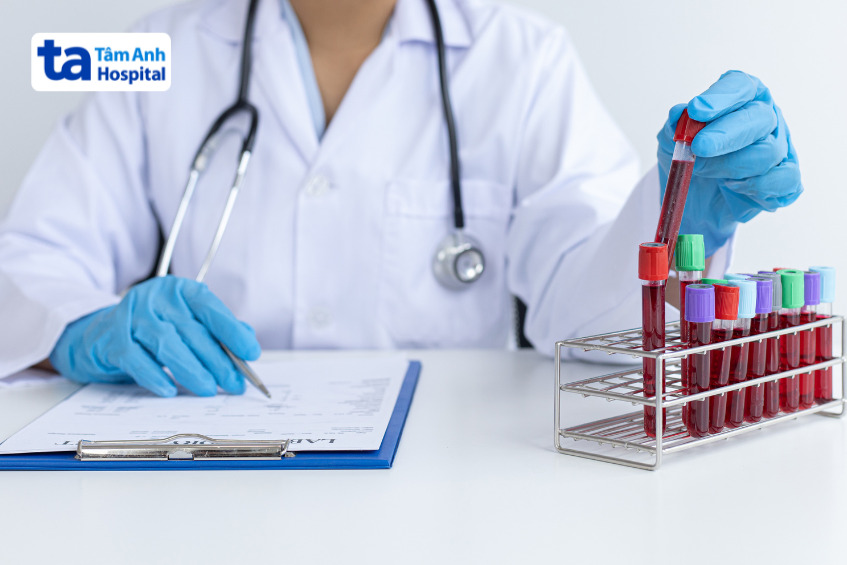 bác sĩ đang kiểm tra mẫu máu