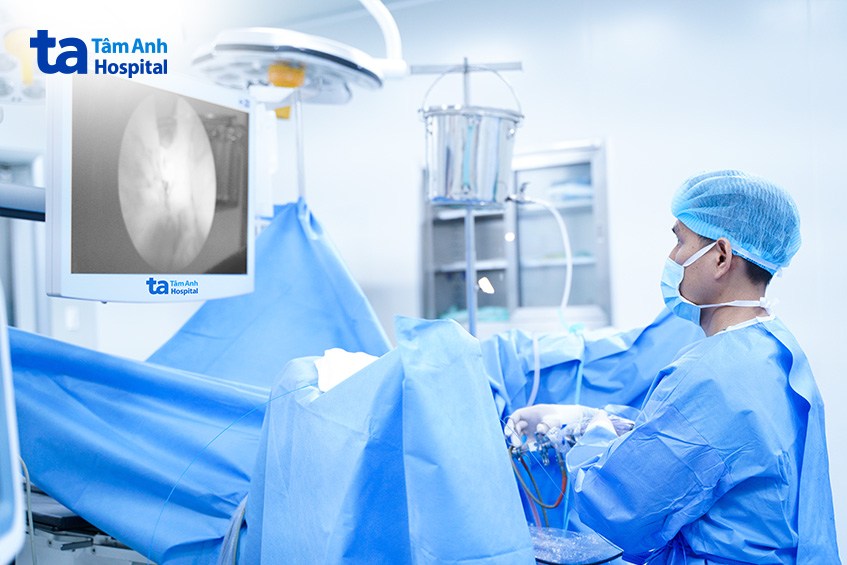 bác sĩ duy thực hiện phẫu thuật bóc nhân tuyến tiền liệt bằng laser