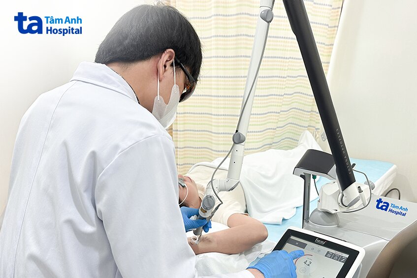 bác sĩ thực hiện xóa xăm cho người bệnh