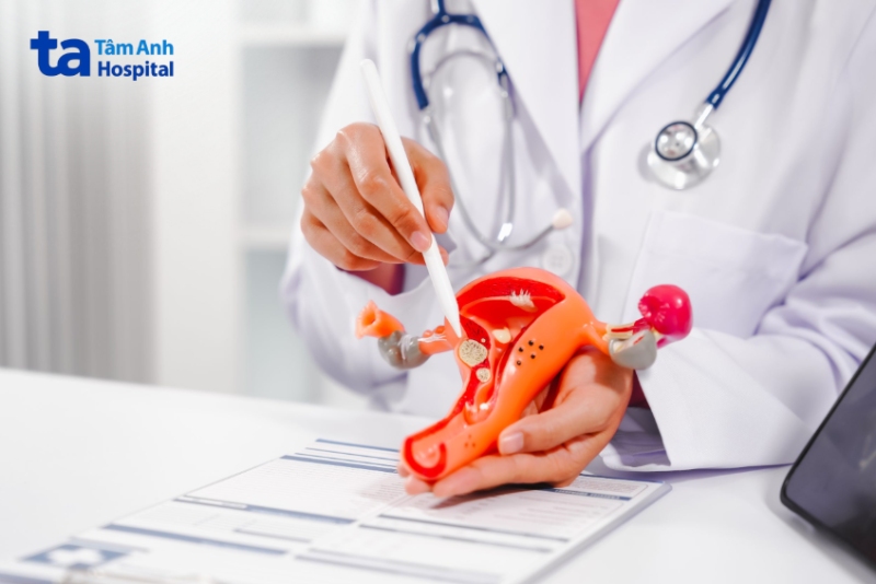 bác sĩ tư vấn điều trị u nang